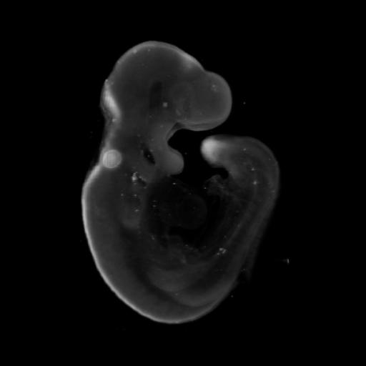3D computer representation of a theiler stage 15 mouse embryo in situ hybridized with a Wnt3A probe