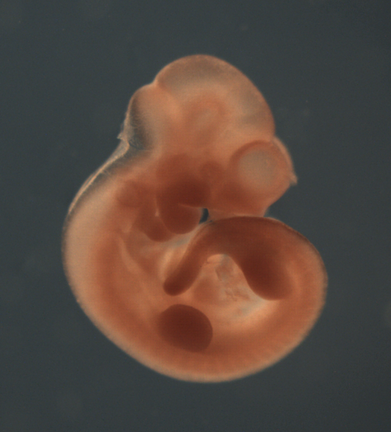 photo of a theiler stage 17 mouse embryo in situ hybridized with a Wnt3A probe