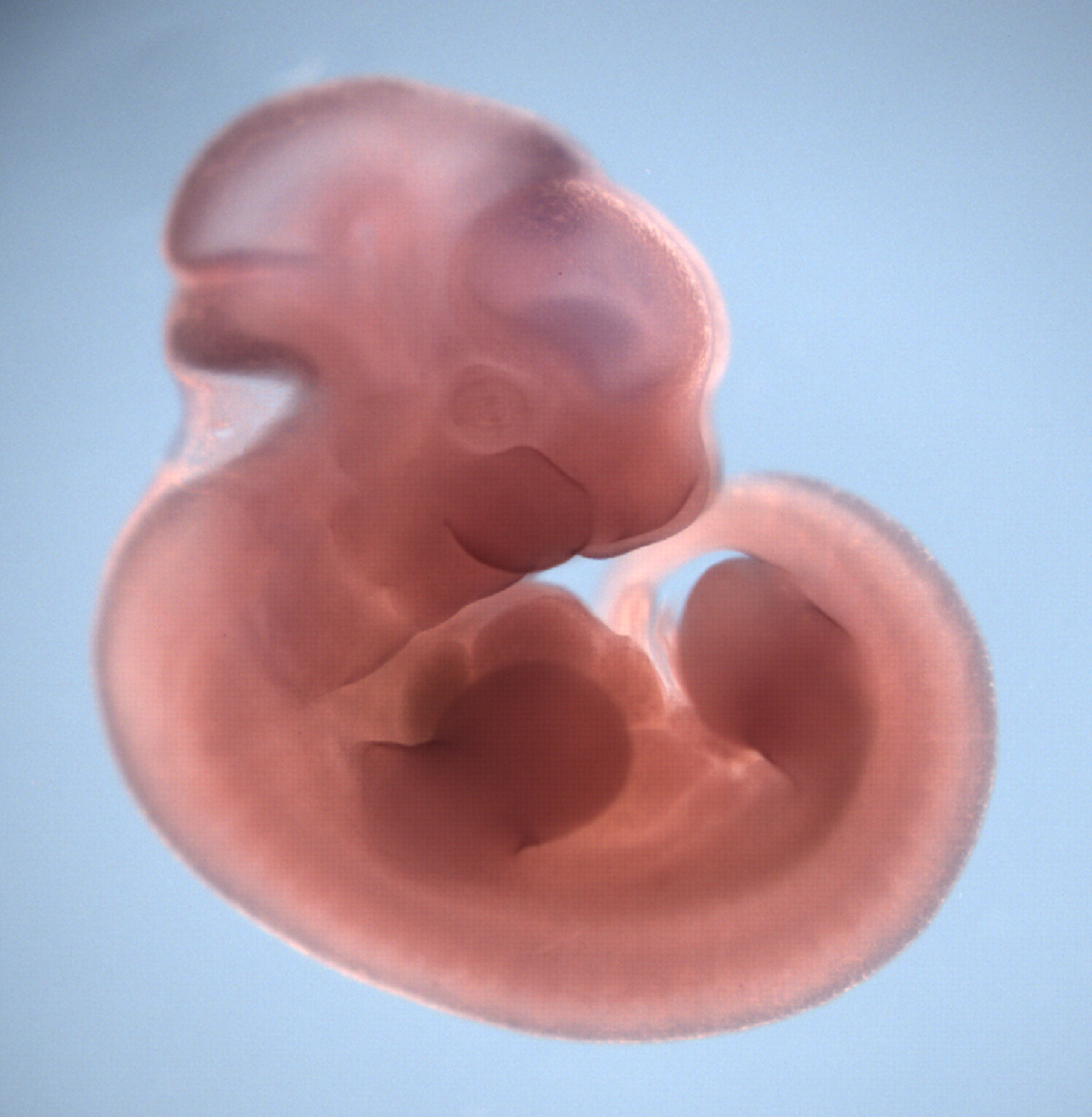 photo of a theiler stage 19 mouse embryo in situ hybridized with a wnt 3 probe