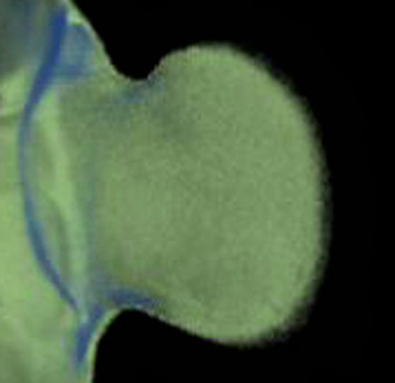 3D computer representation of a theiler stage 19 mouse embryo forelimb in situ hybridized with a wnt 3 probe