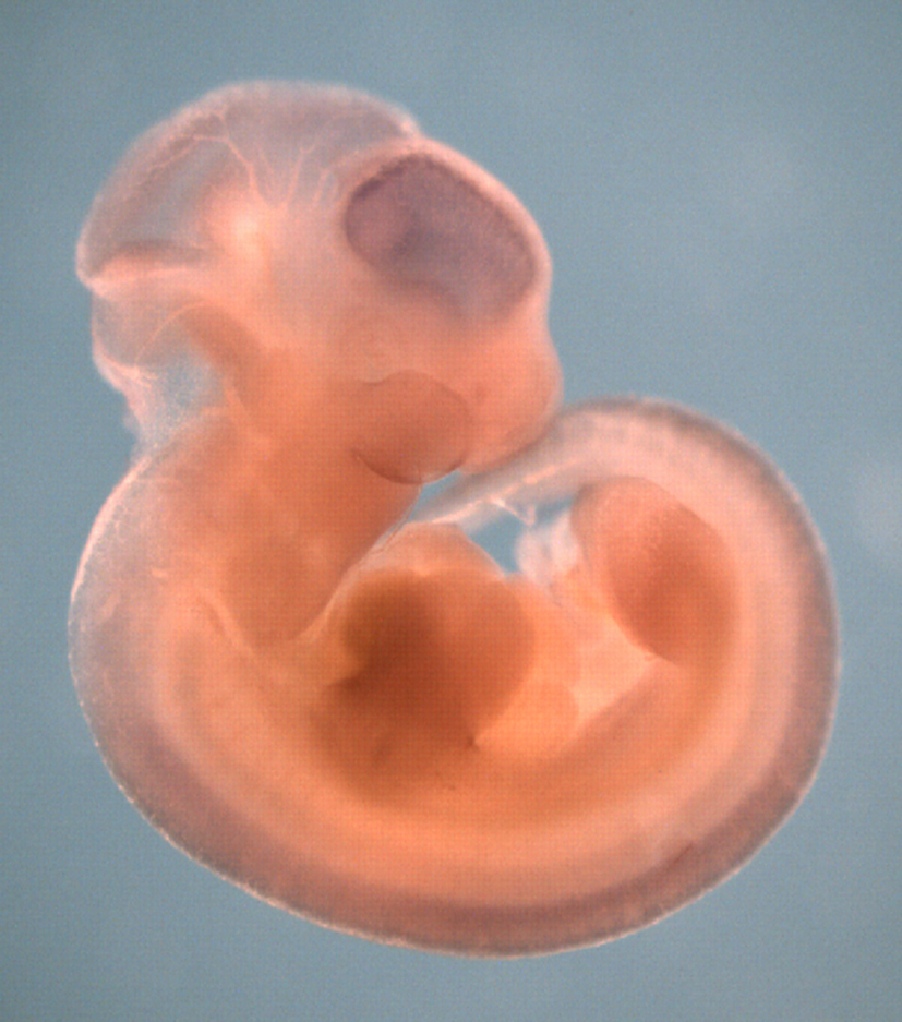photo of a theiler stage 19 mouse embryo in situ hybridized with a wnt 4 probe