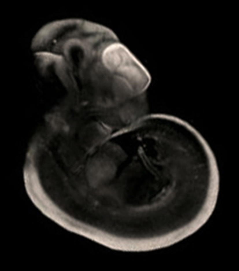 3D computer representation of a theiler stage 19 mouse embryo in situ hybridized with a wnt 4 probe