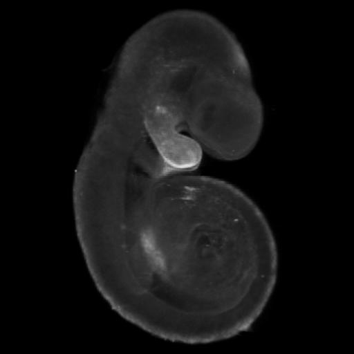 3D computer representation of a theiler stage 15 mouse embryo in situ hybridized with a wnt 4 probe