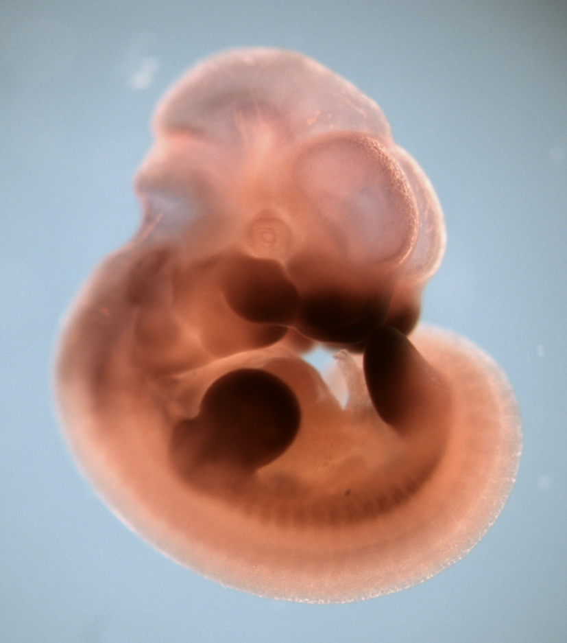 photo of a theiler stage 19 mouse embryo in situ hybridized with a wnt 5a probe
