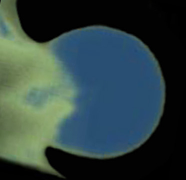 3D computer representation of a theiler stage 19 mouse forelimb in situ hybridized with a wnt 5a probe