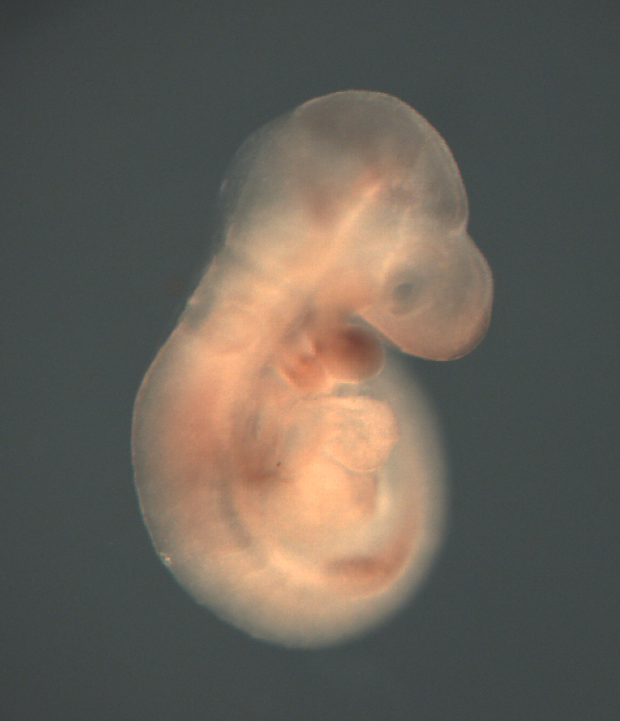 photo of a theiler stage 15 mouse embryo in situ hybridized with a wnt 5a probe