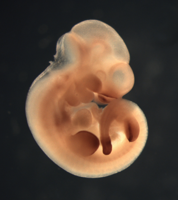 photo of a theiler stage 17 mouse embryo in situ hybridized with a wnt 5a probe
