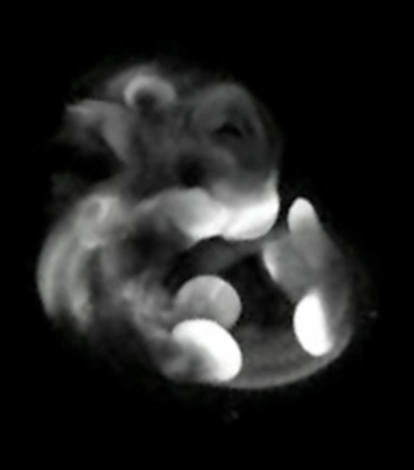 3D computer representation of a theiler stage 19 mouse embryo in situ hybridized with a wnt 5a probe