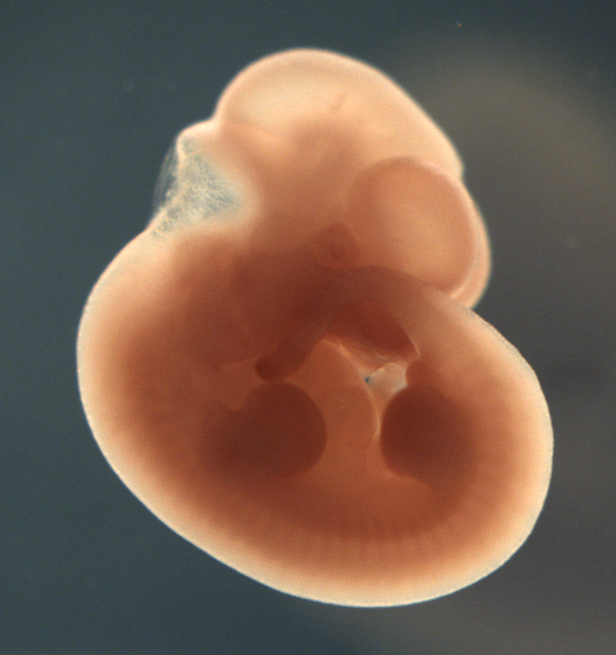 photo of a theiler stage 19 mouse embryo in situ hybridized with a wnt 5b probe