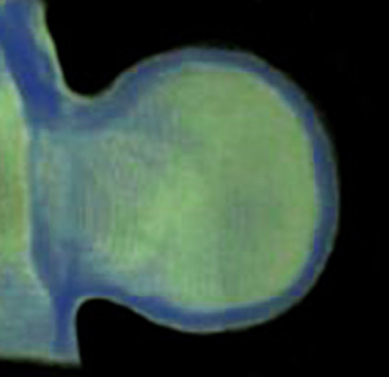 3D computer representation of a theiler stage 19 mouse forelimb in situ hybridized with a wnt 6 probe