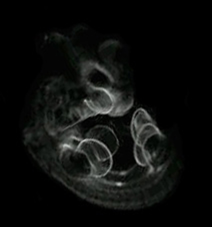 3D computer representation of a theiler stage 19 mouse embryo  in situ hybridized with a wnt 6 probe