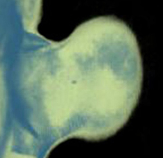 3D computer representation of a theiler stage 19 mouse embryo forelimb in situ hybridized with a wnt 7a probe