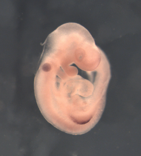 photo of a theiler stage 15 mouse embryo in situ hybridized with a wnt 7a probe