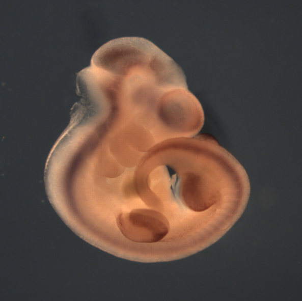 photo of a theiler stage 17 mouse embryo in situ hybridized with a wnt 7a probe