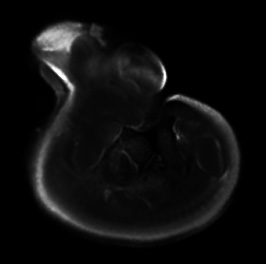 3D representation of the Wnt 7A expression pattern in a theiler stage 19 mouse embryo