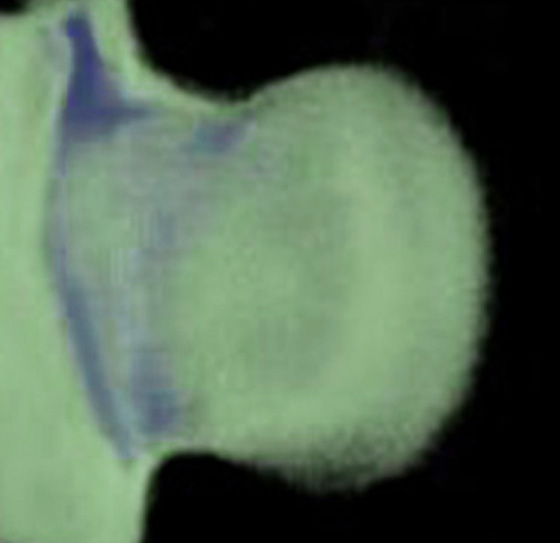 3D computer representation of a theiler stage 19 mouse embryo forelimb in situ hybridized with a wnt 7b probe