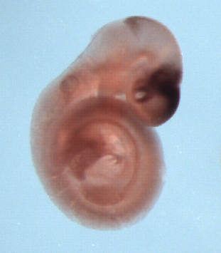 photo of a theiler stage 15 mouse embryo in situ hybridized with a wnt 7b probe