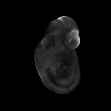 3D computer representation of a theiler stage 15 mouse embryo in situ hybridized with a wnt 7b probe