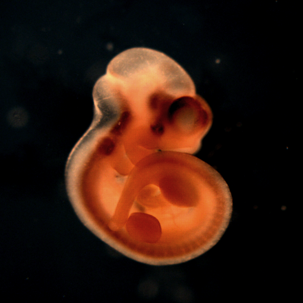 photo of a theiler stage 17 mouse embryo in situ hybridized with a wnt 7b probe