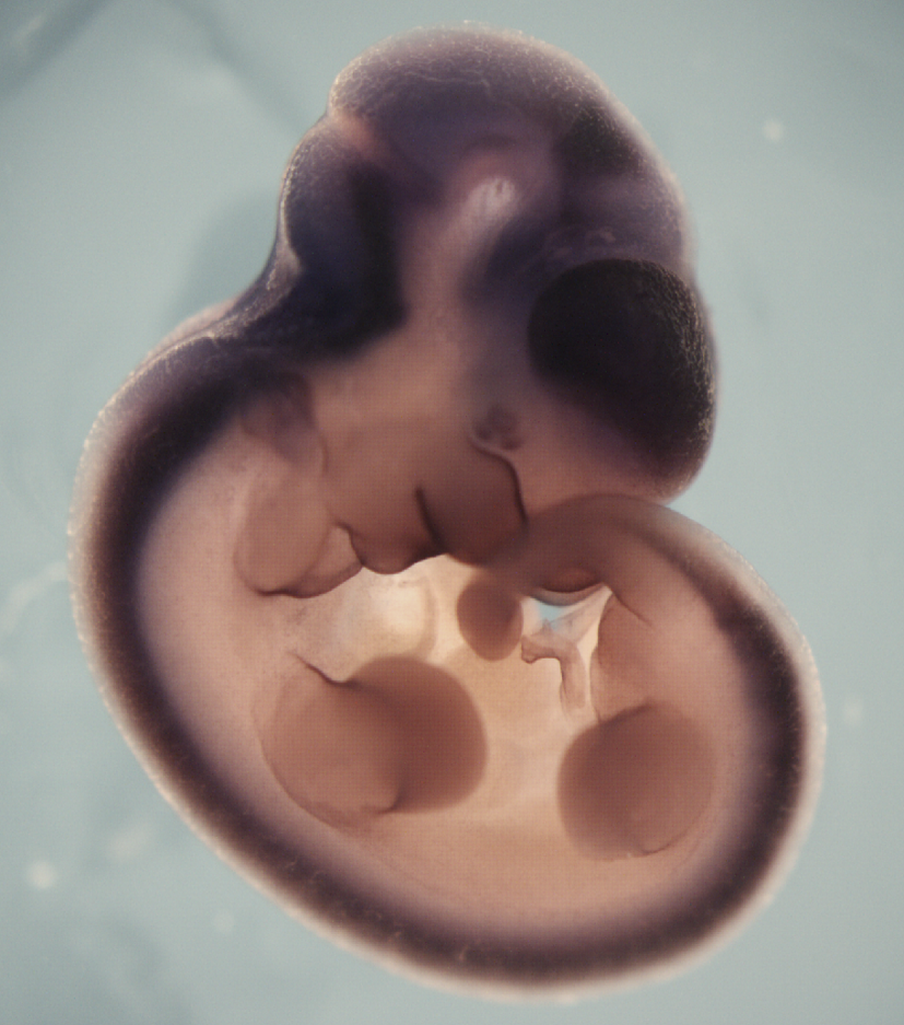 photo of a theiler stage 19 mouse embryo in situ hybridized with a wnt 7b probe