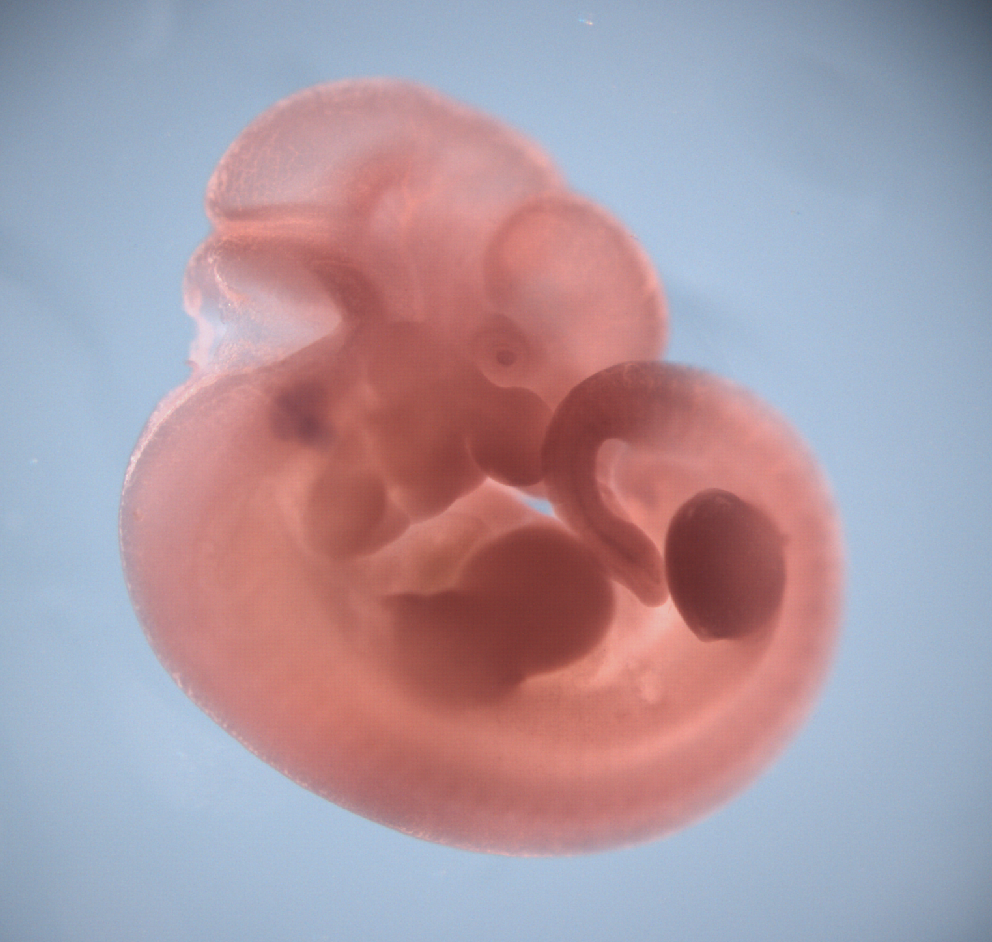 photo of a theiler stage 19 mouse embryo in situ hybridized with a wnt 8a probe