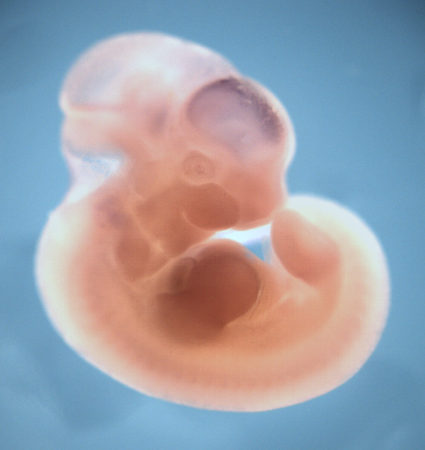 photo of a theiler stage 19 mouse embryo in situ hybridized with a wnt 8b probe