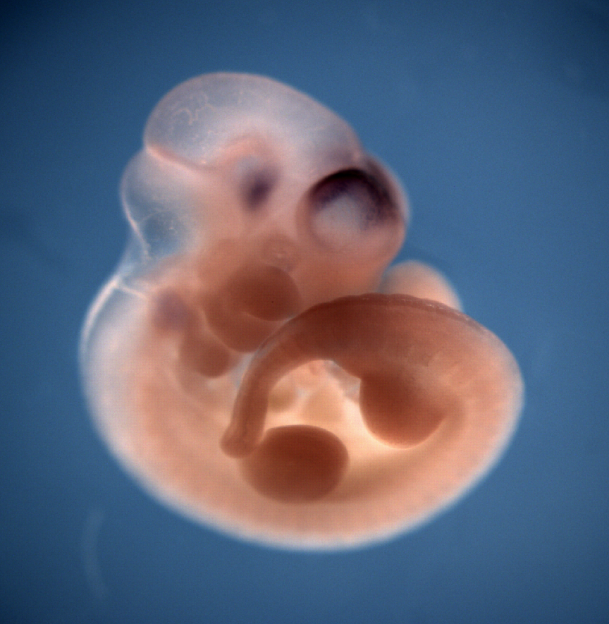 photo of a theiler stage 17 mouse embryo in situ hybridized with a wnt 8b probe
