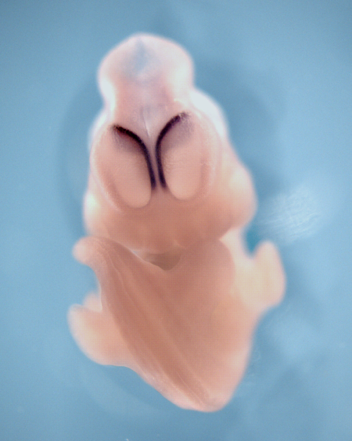 photo of a theiler stage 19 mouse embryo in situ hybridized with a wnt 8b probe