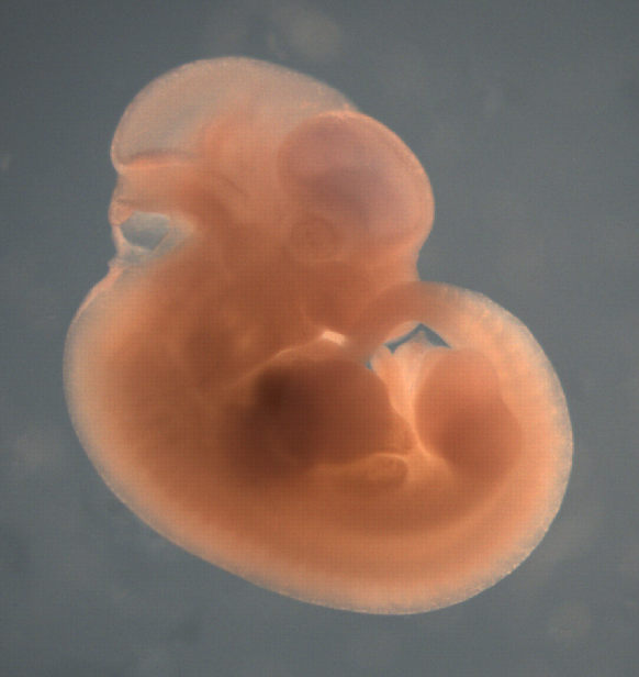 photo of a theiler stage 19 mouse embryo in situ hybridized with a wnt 9b probe