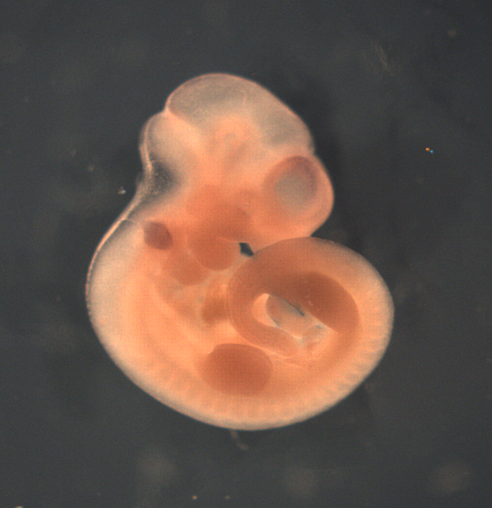 photo of a theiler stage 17 mouse embryo in situ hybridized with a wnt 9a probe