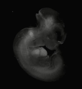 3d computer reconstruction of a mouse embryo in situ hybridized with a wnt 9a probe