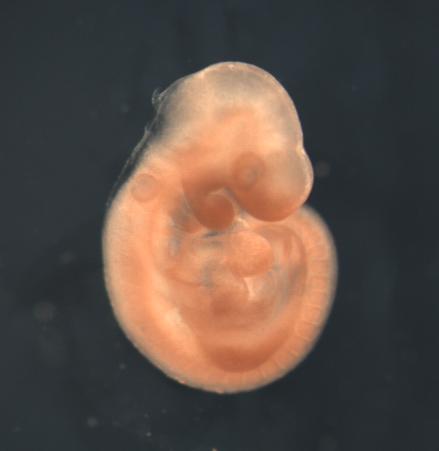 photo of a theiler stage 15 mouse embryo in situ hybridized with a wnt 9b probe