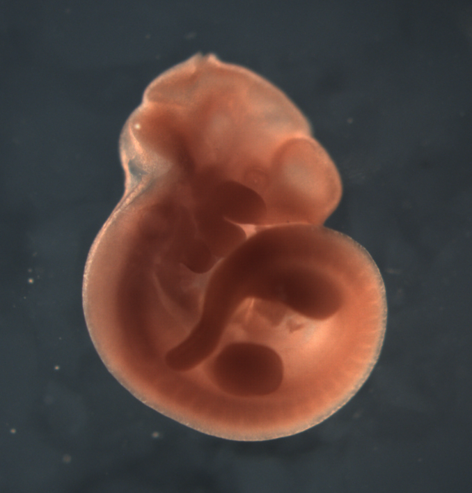 photo of a theiler stage 17 mouse embryo in situ hybridized with a wnt 9b probe