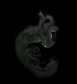 3d computer reconstruction of a mouse embryo in situ hybridized with a wnt 9b probe