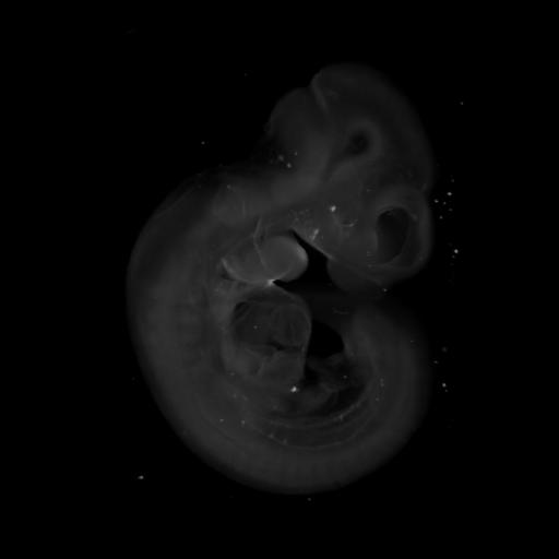 3D computer representation of a theiler stage 17 mouse embryo in situ hybridized with a wnt 9b probe
