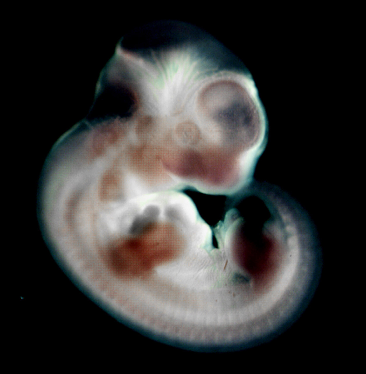 photo of an e11.5 mouse embryo in situ hybridized with a ß-Catenin probe