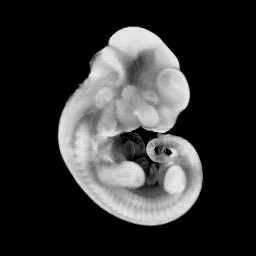 3D computer representation of an e11.5 mouse embryo in situ hybridized with a ß-Catenin probe