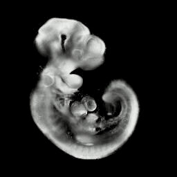 3D computer representation of an e9.5 mouse embryo in situ hybridized with a ß-Catenin probe