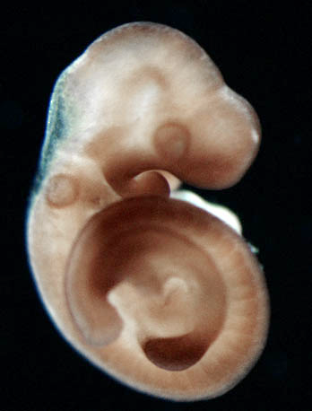 photo of an e9.5 mouse embryo in situ hybridized with a ß-Catenin probe