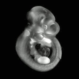 3D computer representation of an e10.5 mouse embryo in situ hybridized with a lef1 probe