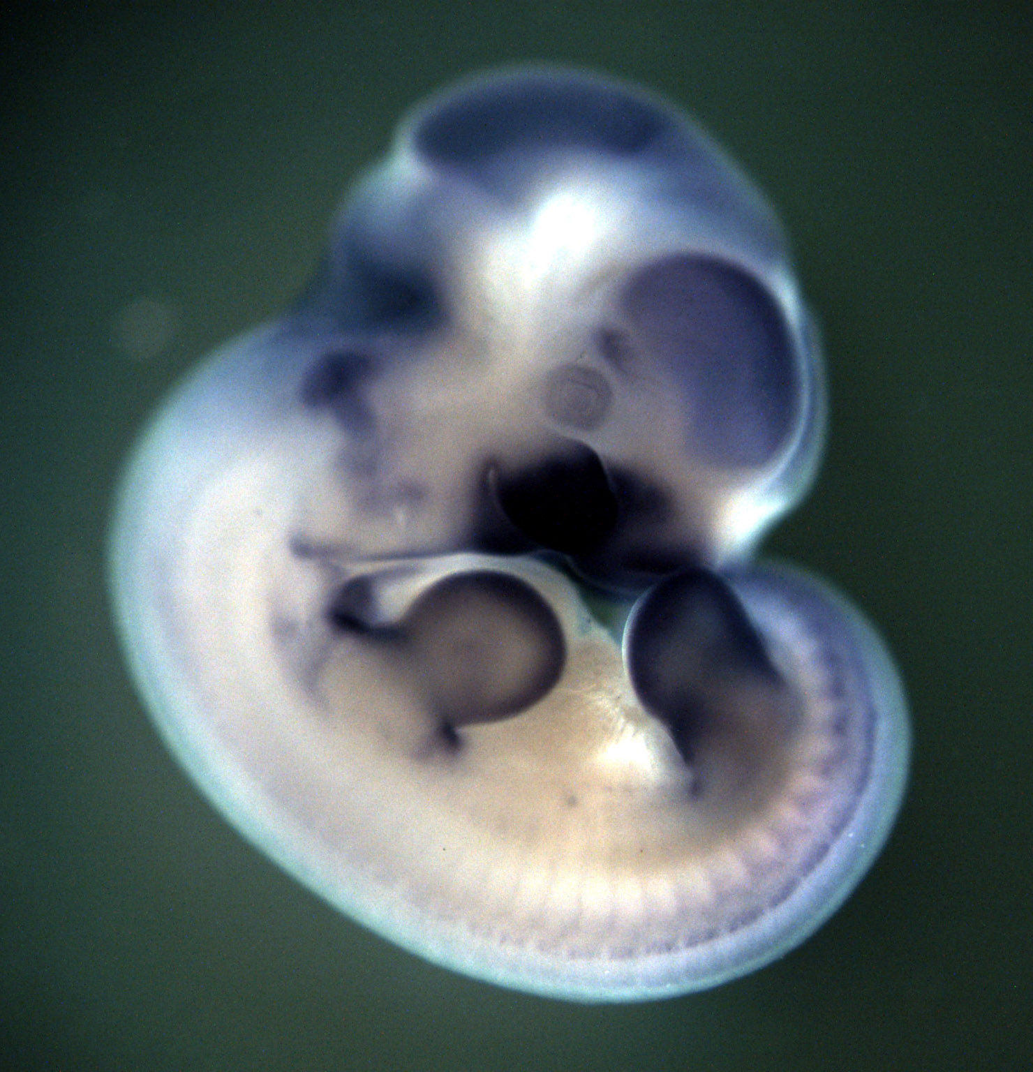 photo of an e11.5 mouse embryo in situ hybridized with a lef1 probe
