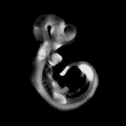 3D computer representation of an e9.5 mouse embryo in situ hybridized with a lef1 probe