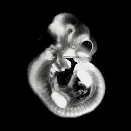 3D computer representation of an e10.5 mouse embryo in situ hybridized with a tcf1 probe