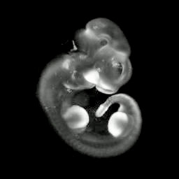 3d computer representation of an e11.5 mouse embryo in sity hybridized with a tcf1 probe