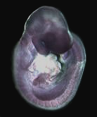 photo of an e9.5 mouse embryo in situ hybridized with a tcf1 probe