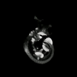 3D computer representation of an e9.5 mouse embryo in situ hybridized with a tcf1 probe