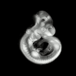 3D computer representation of an e10.5 mouse embryo in situ hybridized with a tcf3 probe
