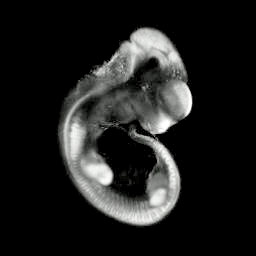 3D computer representation of an e11.5 mouse embryo in situ hybridized with a tcf3 probe