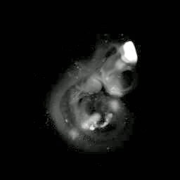 3D computer representaiton of an e10.5 mouse embryo in situ hybridized with a tcf4 probe
