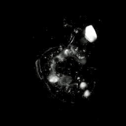 3D computer representaiton of a e11.5 mouse embryo in situ hybridized with a tcf4 probe